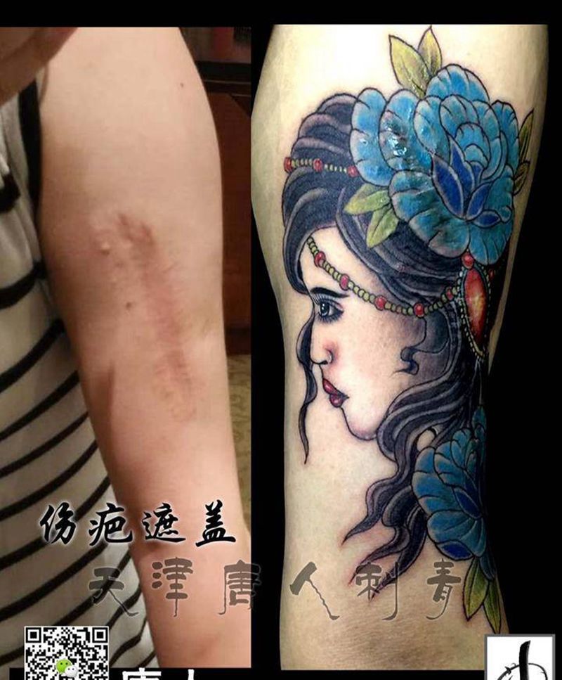 伤疤遮盖纹身图片_
