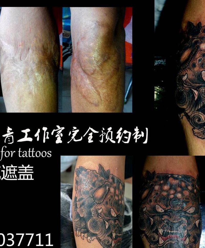 盖重疤纹身图片_
