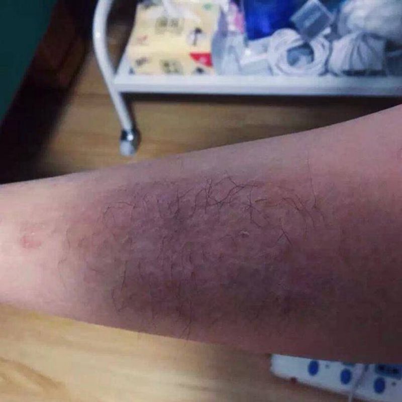 覆盖伤疤纹身图片_