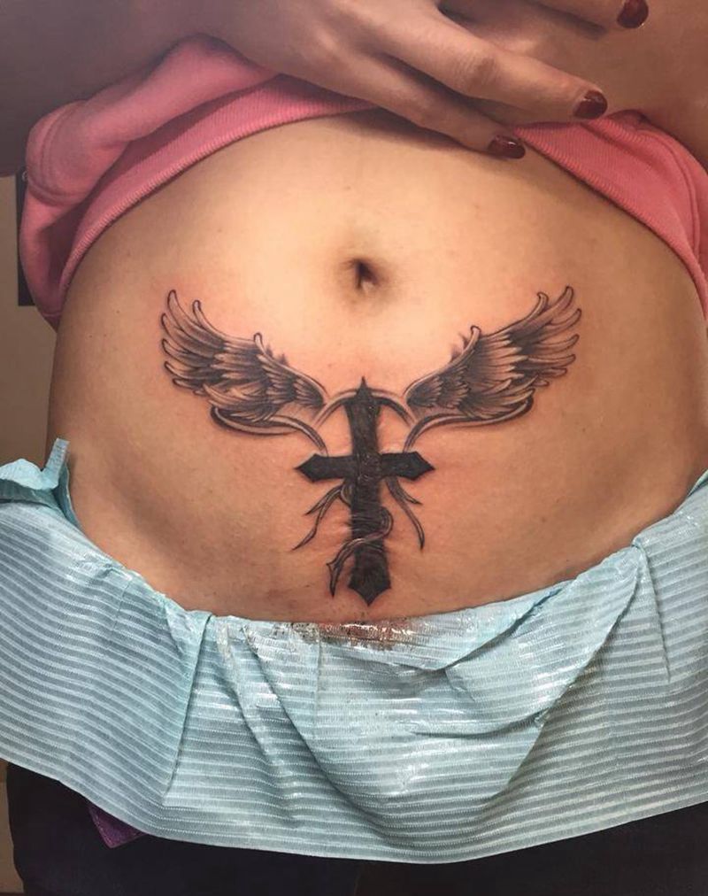 疤痕 剖腹产疤痕 遮盖纹身图片