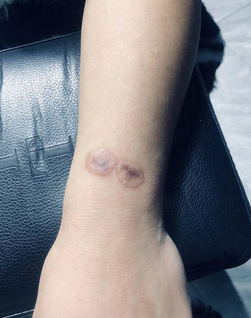 烟疤遮盖纹身图片_手部水墨纹身图案