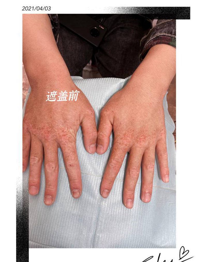 遮盖疤痕纹身图片_手部水墨纹身图案