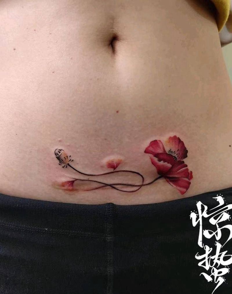 剖腹产疤痕遮盖纹身图片_腹部水墨遮盖纹身图案