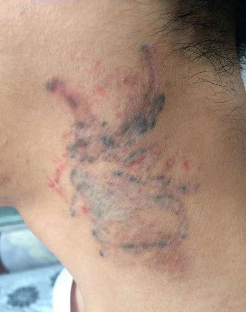 洗纹身纹身图片_颈部纹身图案