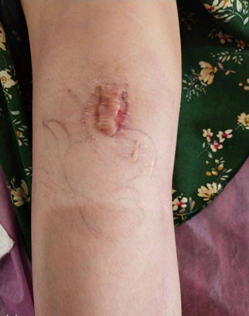 遮盖疤痕纹身图片_腿部新传统纹身图案