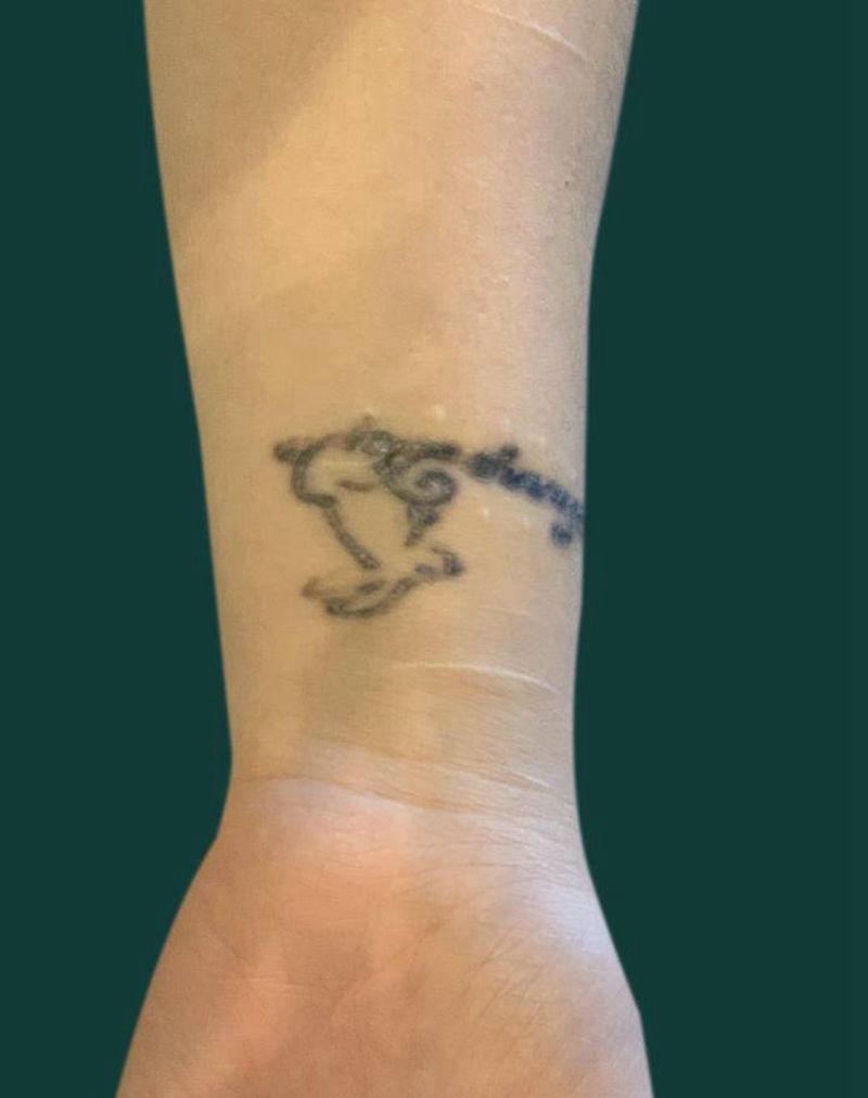 新传统臂环遮盖纹身图片_手臂新传统纹身图案