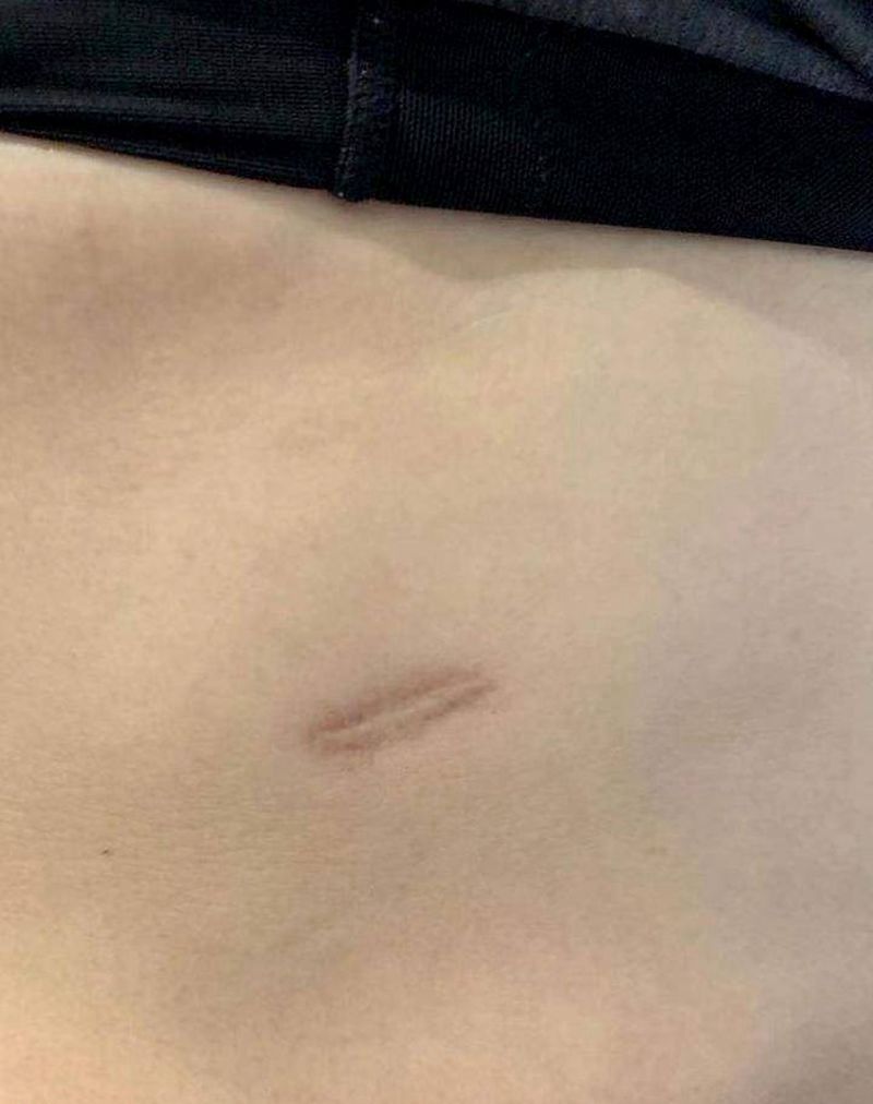 伤疤遮盖小花纹身图片_腹部水彩纹身图案