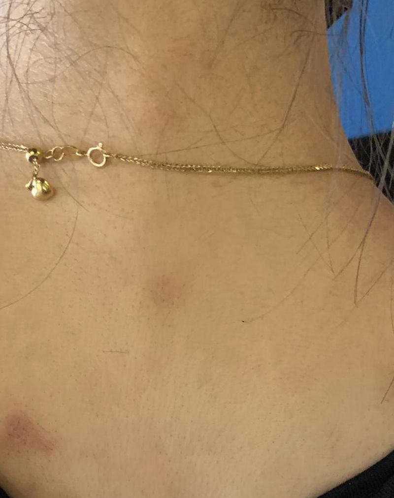 水墨疤痕遮盖纹身图片_背部水墨纹身图案