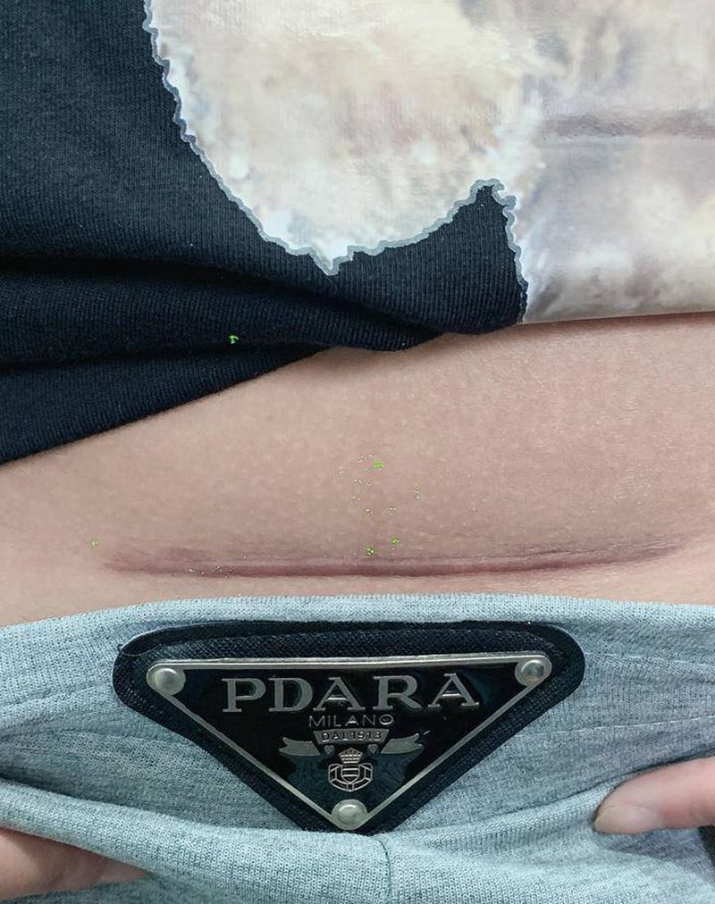 疤痕遮盖纹身图片_腹部纹身图案