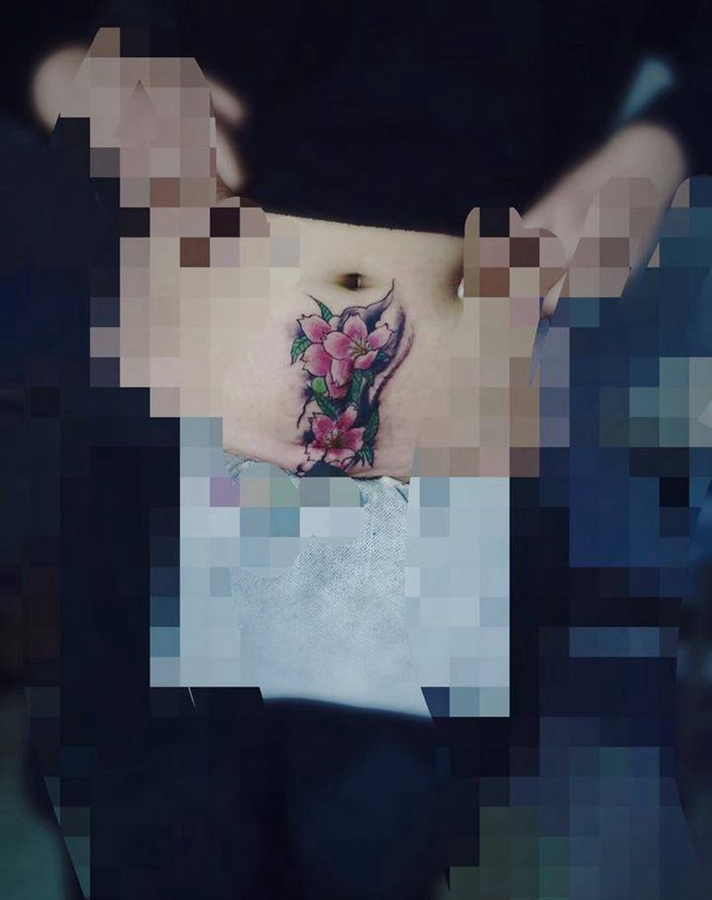 刨腹产遮盖纹身图片