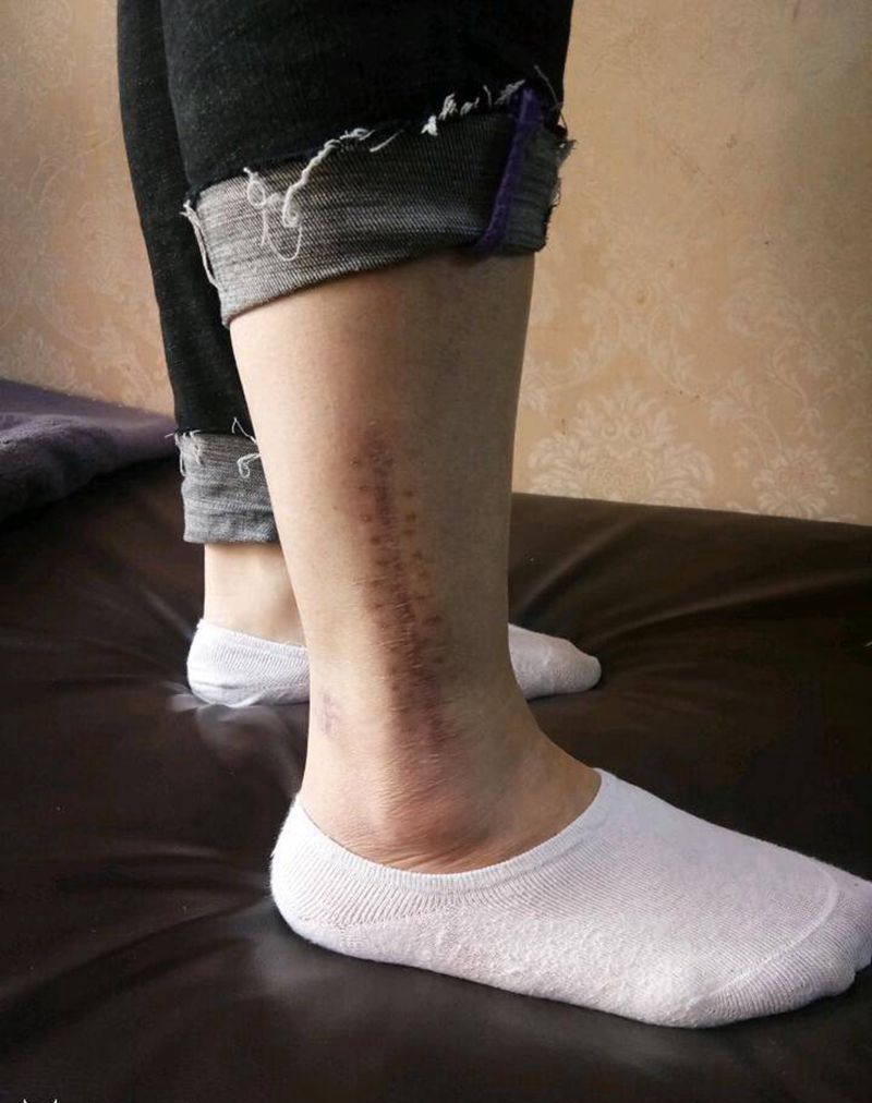 全彩写实玫瑰遮盖疤痕纹身图片