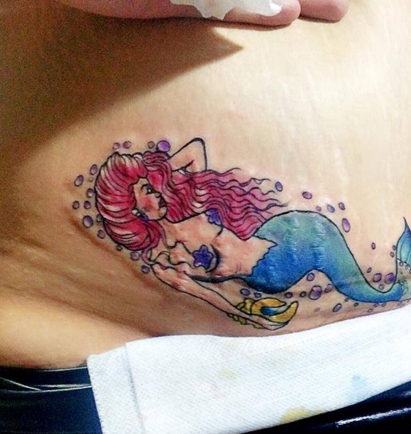 妊娠纹，刨腹产纹身图片