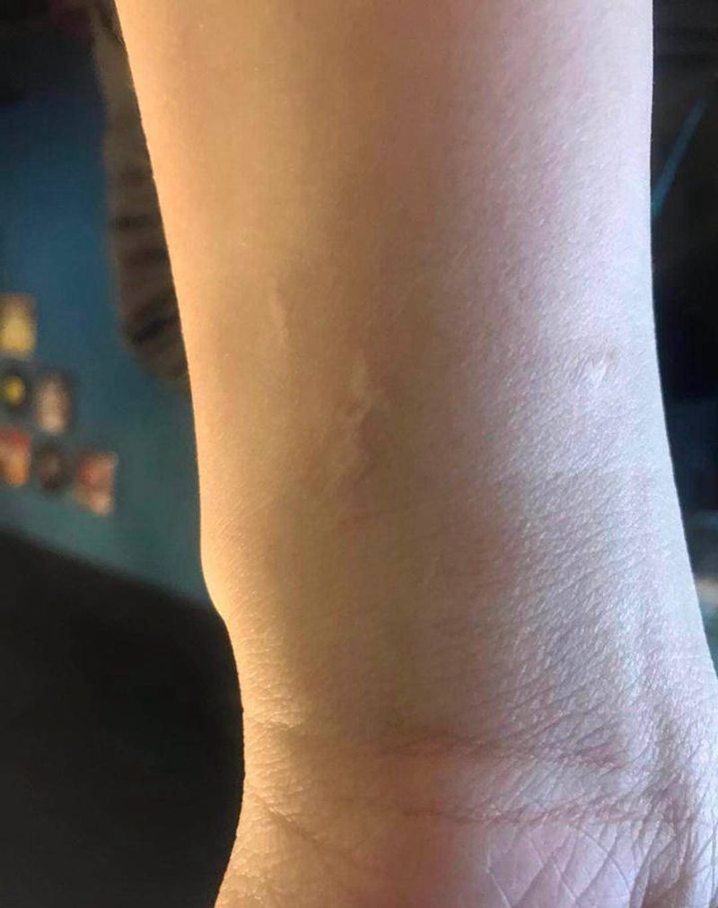 伤疤遮盖纹身图片