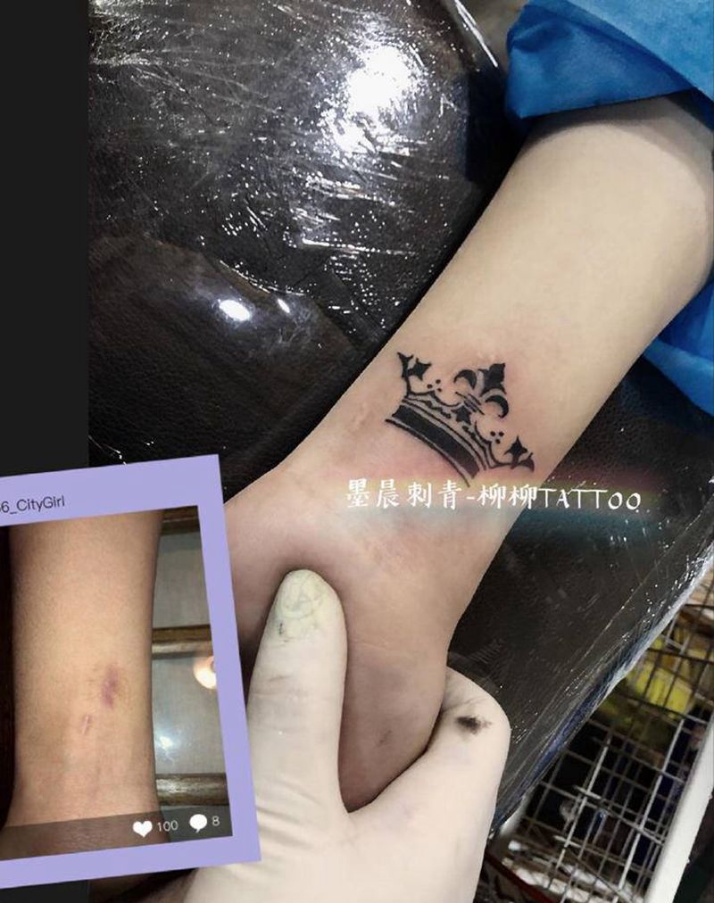 疤痕覆盖纹身图片_手臂纹身图案