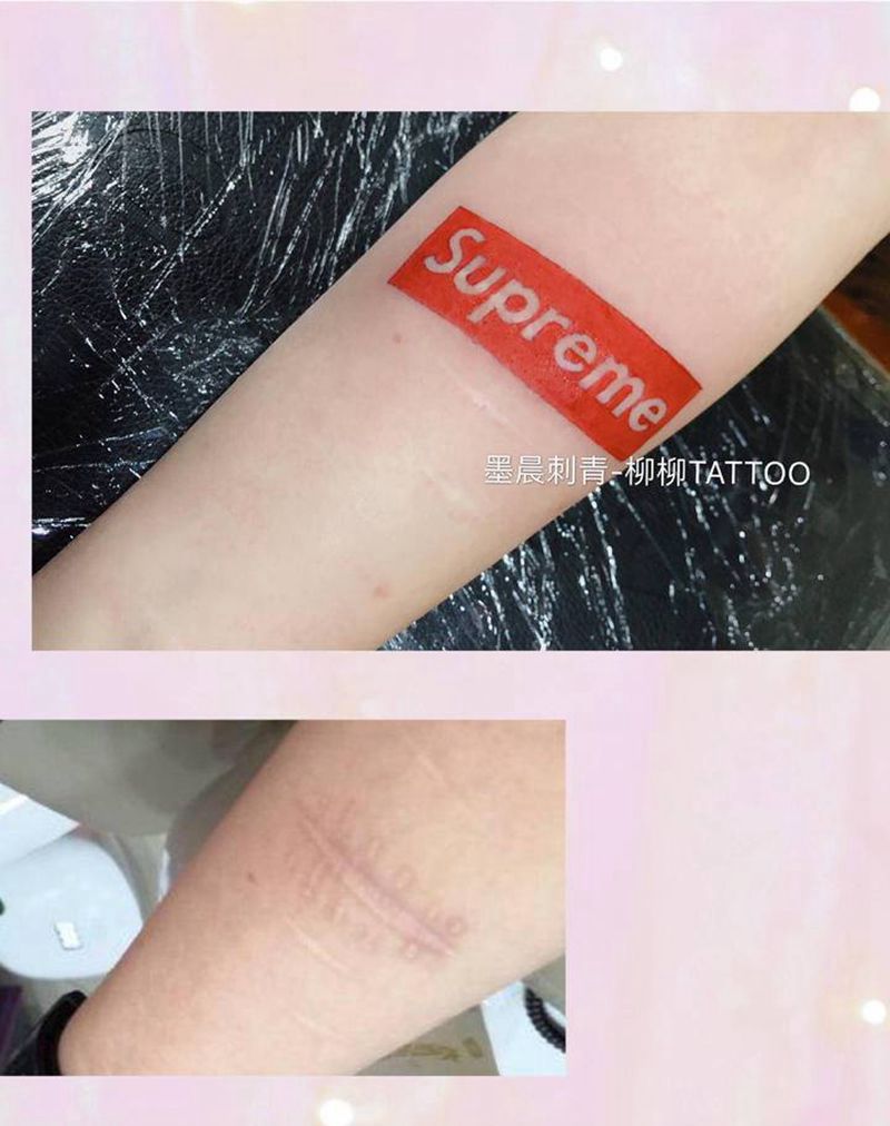 疤痕覆盖纹身图片_手臂纹身图案