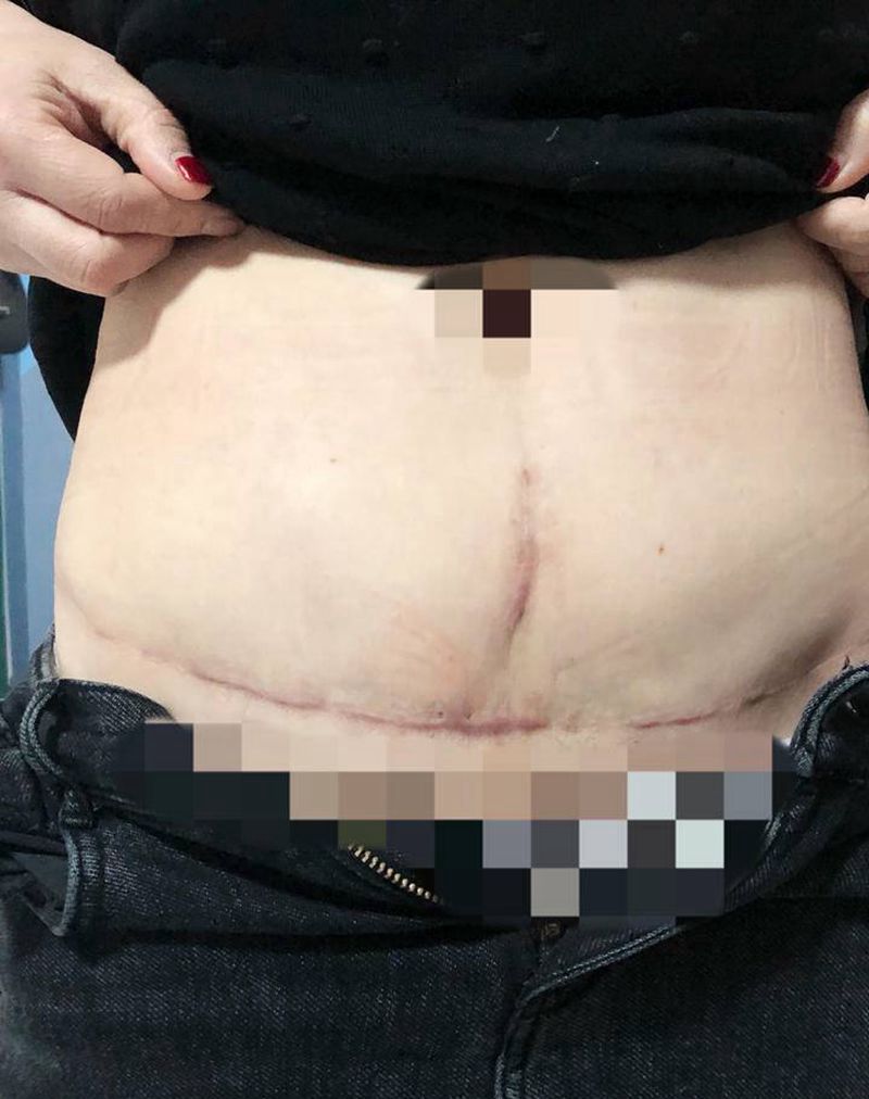 疤痕遮盖纹身图片_腹部纹身图案