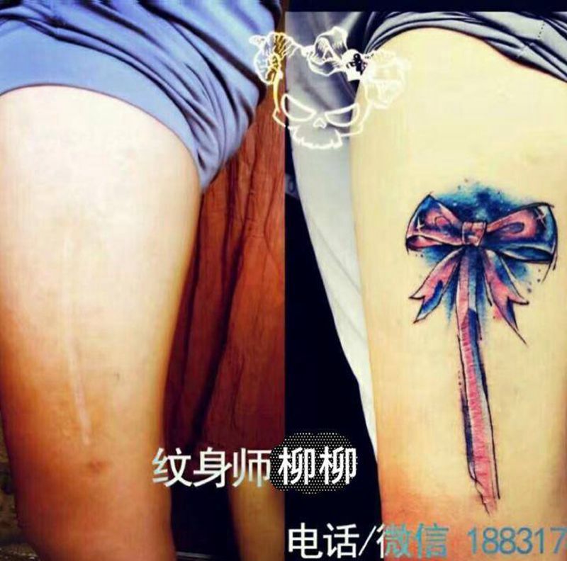 疤痕遮盖纹身图片