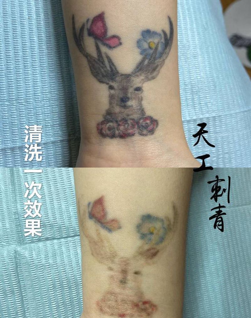 无痛皮秒洗纹身纹身图片_洗纹身纹身图案