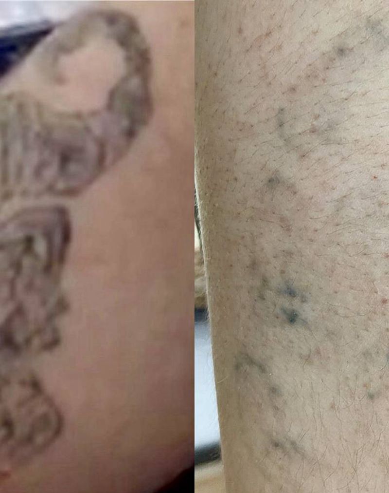 还差最后一次洗净纹身图片_洗纹身纹身图案