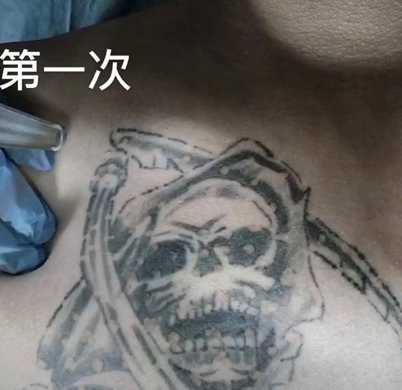 还差最后一次收尾洗净纹身图片_洗纹身纹身图案