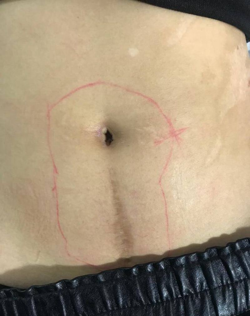 遮盖伤疤纹身图片