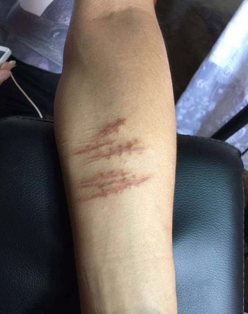 疤痕覆盖，水墨效果纹身图片