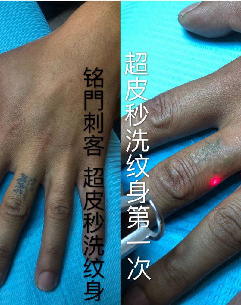 超皮秒洗纹身纹身图片_手部纹身图案