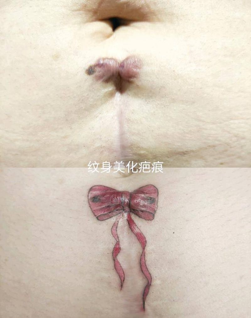 纹身美化疤痕纹身图片_腹部遮盖疤痕纹身图案