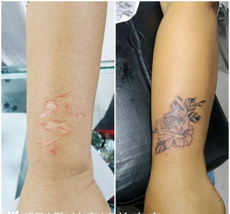 素花遮盖疤痕纹身图片_手部手臂点刺纹身图案