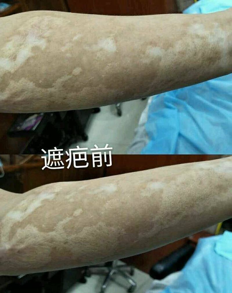 孟师傅遮疤作品纹身图片