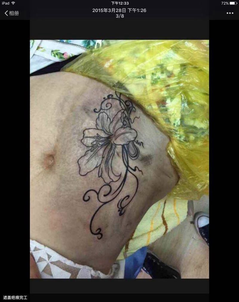 遮盖疤痕百合花纹身图片_腹部纹身图案