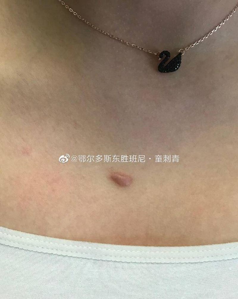 遮盖疤痕纹身图片_胸部纹身图案