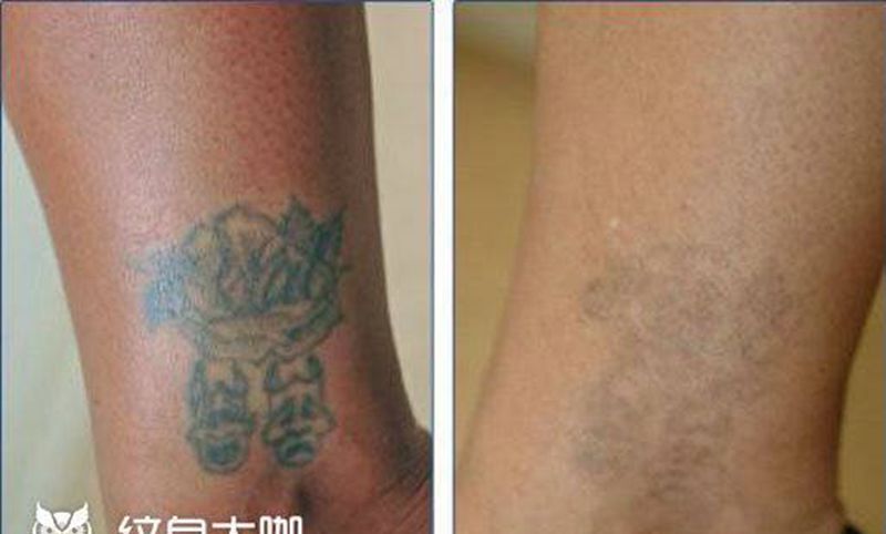 洗纹身纹身图片_手臂背部纹身图案
