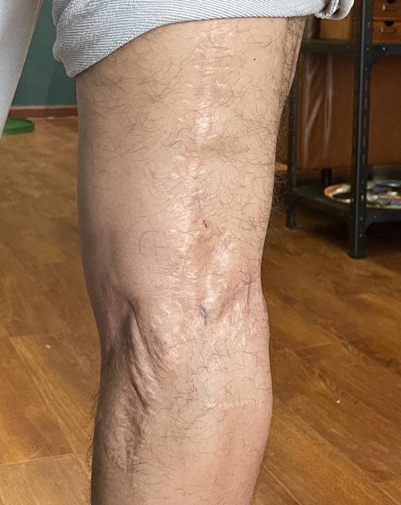 疤痕遮盖纹身图片_Old School纹身图案