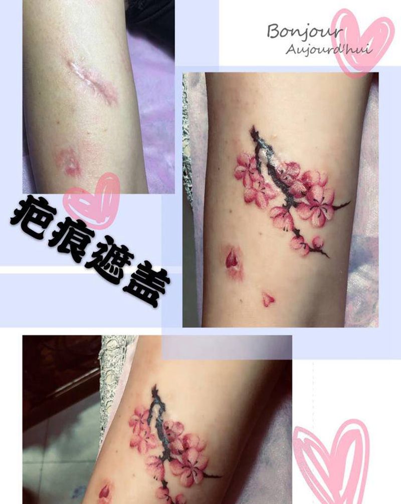 疤痕遮盖纹身图片_手臂纹身图案