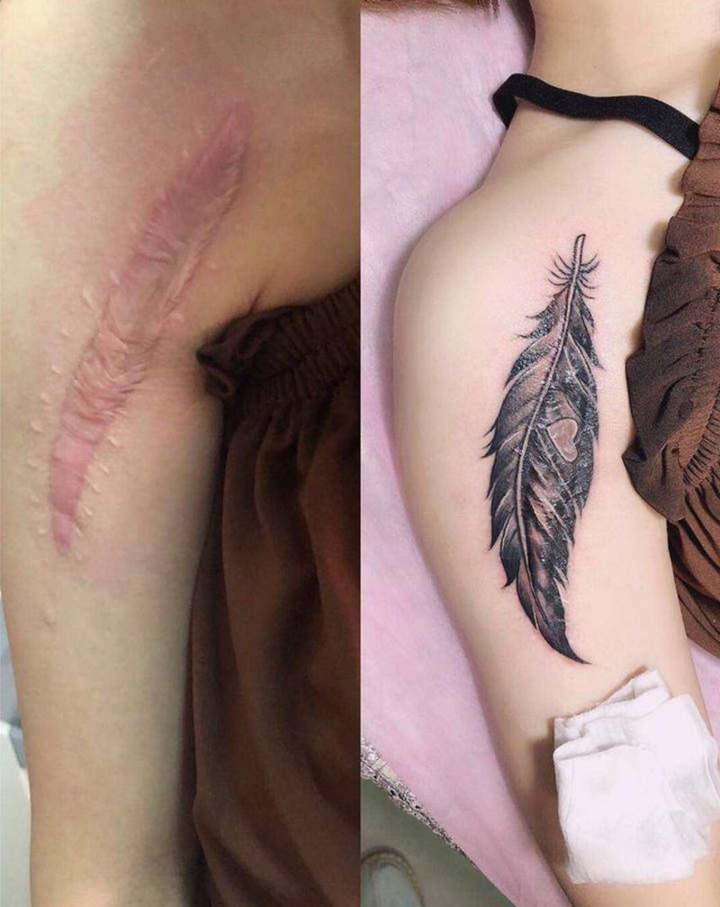 疤痕遮盖纹身图片_手臂纹身图案