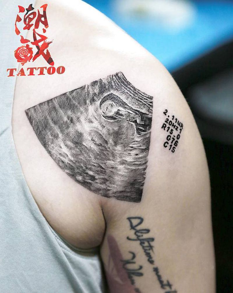 宝宝的第一张B超图纹身图片_手臂欧美写实纹身图案