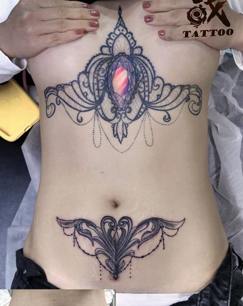 疤痕遮盖纹身图片_腹部点刺疤痕蕾丝曼陀罗纹身图案