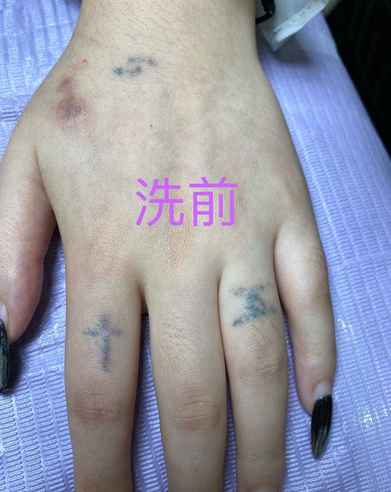 洗纹身部分恢复中作品纹身图片_皮秒洗纹身图案