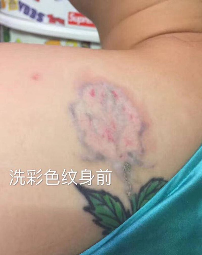 洗纹身部分恢复中作品纹身图片_皮秒激光纹身图案