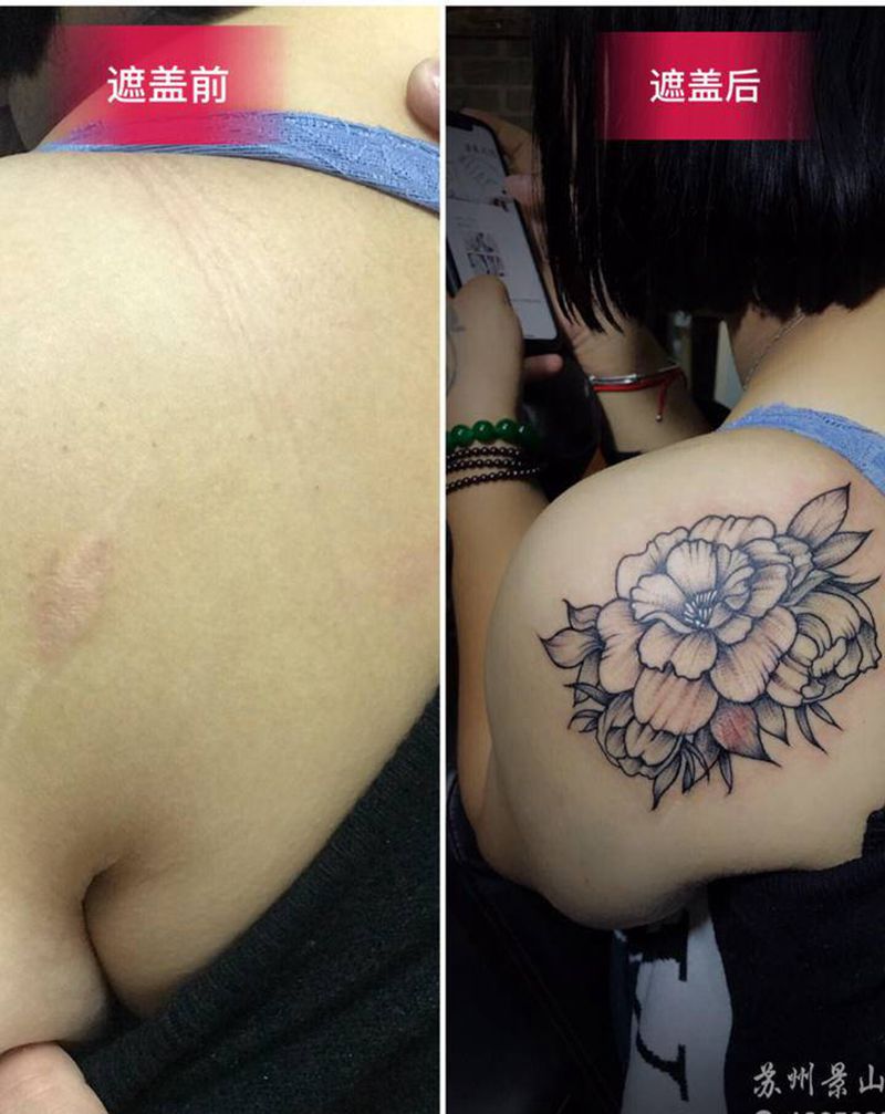 素花胎记遮盖纹身图片_肩部纹身图案