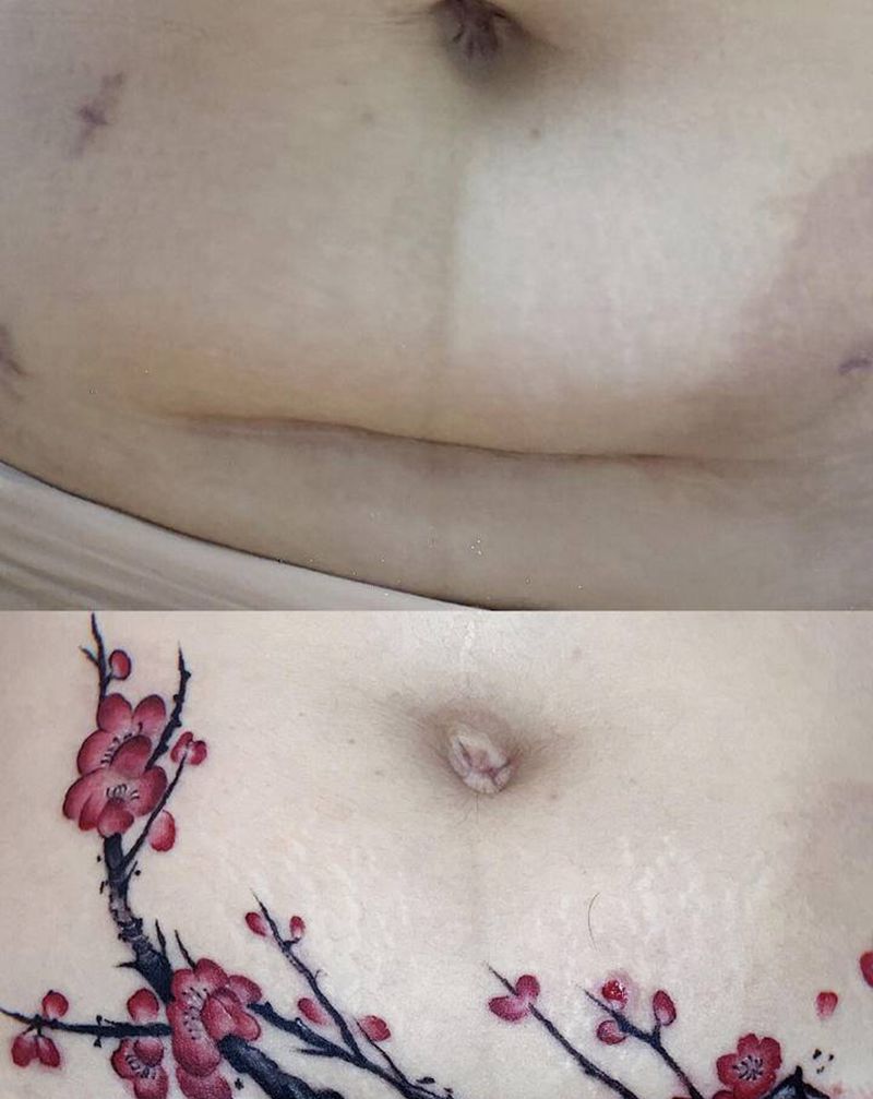 疤痕遮盖 梅花纹身纹身图片_腹部新传统瘢痕遮盖梅花纹身图案