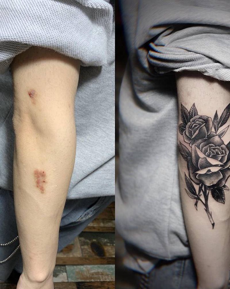 玫瑰花遮盖疤痕纹身图片_手臂Old SchoolNew School玫瑰花纹身图案