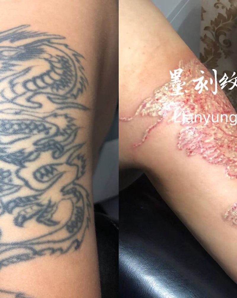 清洗一遍的效果纹身图片_手臂纹身图案