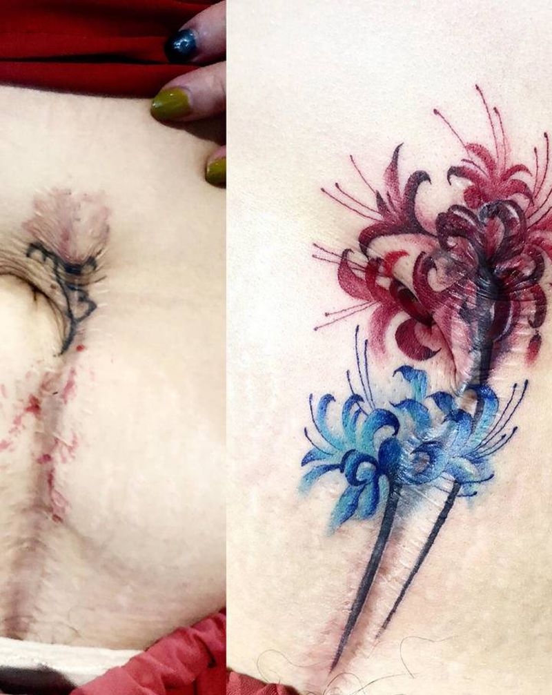 遮盖疤痕纹身图片_腹部背部水彩纹身图案