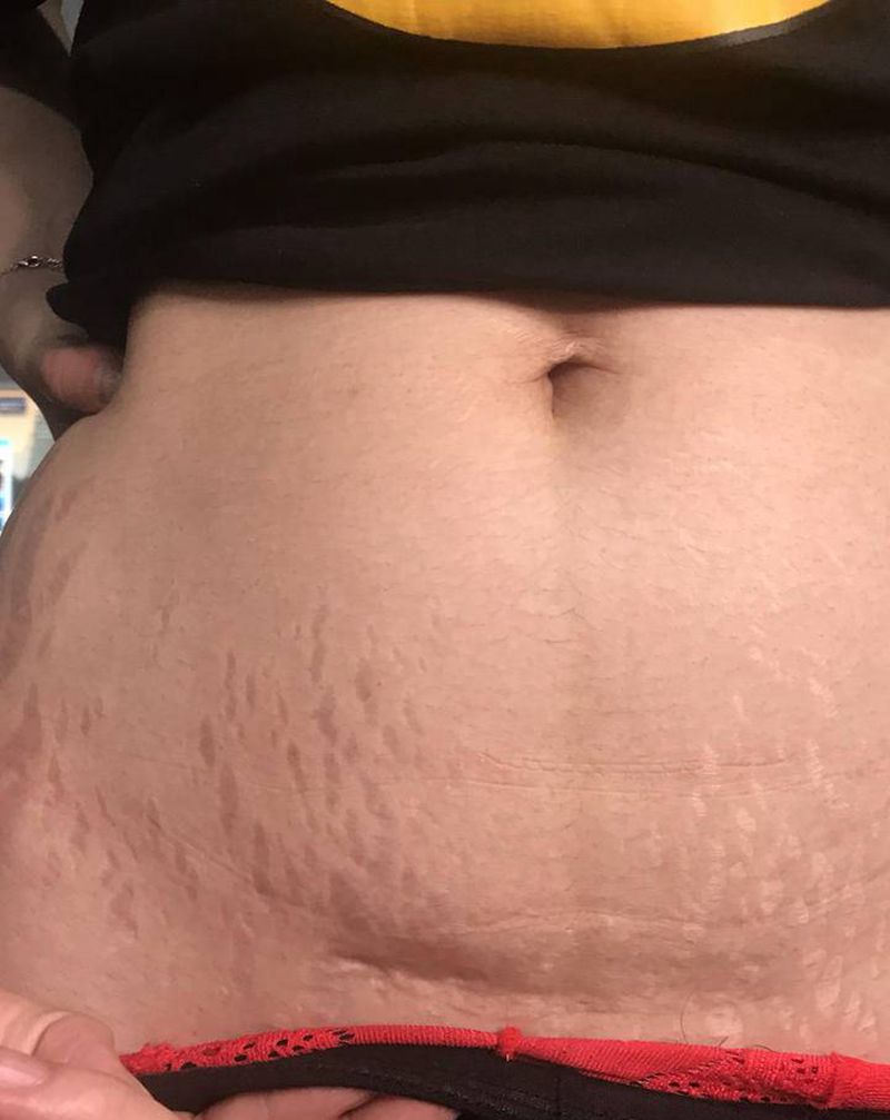 素花遮盖纹身图片_腹部纹身图案