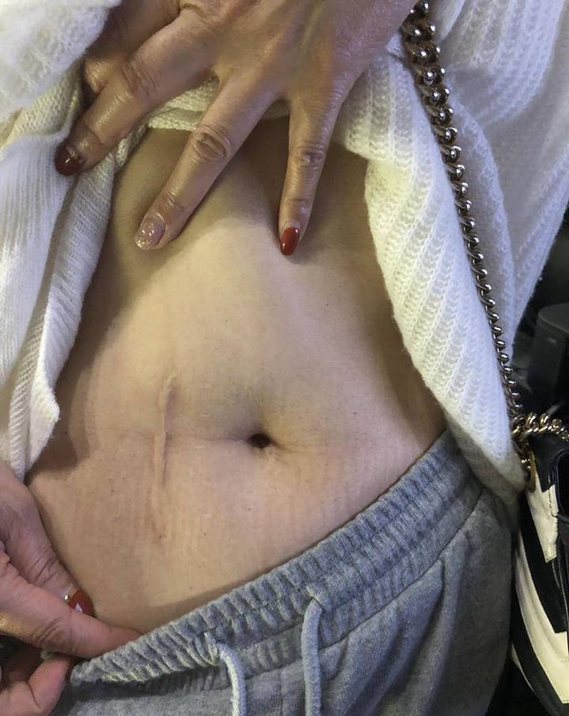 遮盖纹身图片_腹部点刺纹身图案