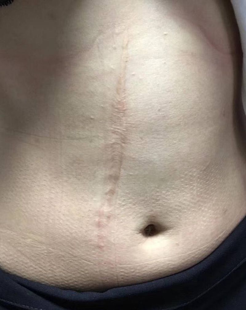 遮盖疤痕纹身图片_腹部胸部水彩纹身图案