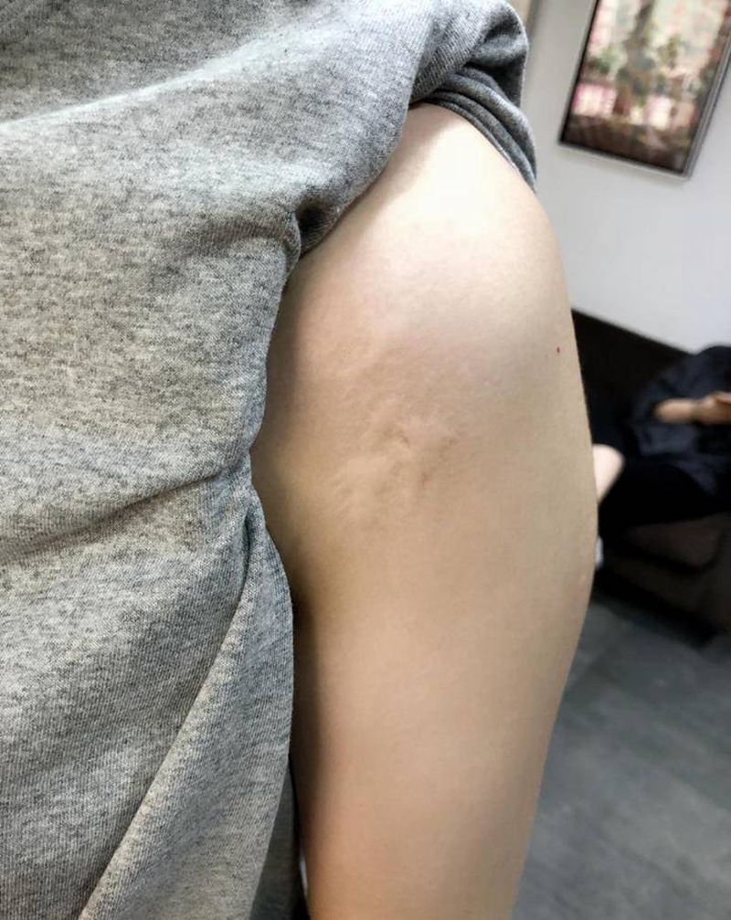 疤痕遮盖纹身图片_手臂手部水彩纹身图案