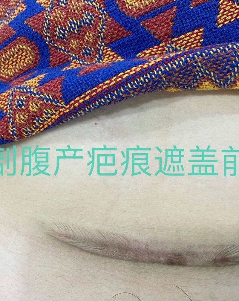 剖腹产疤痕遮盖 樱花纹身图片_腹部水彩纹身图案